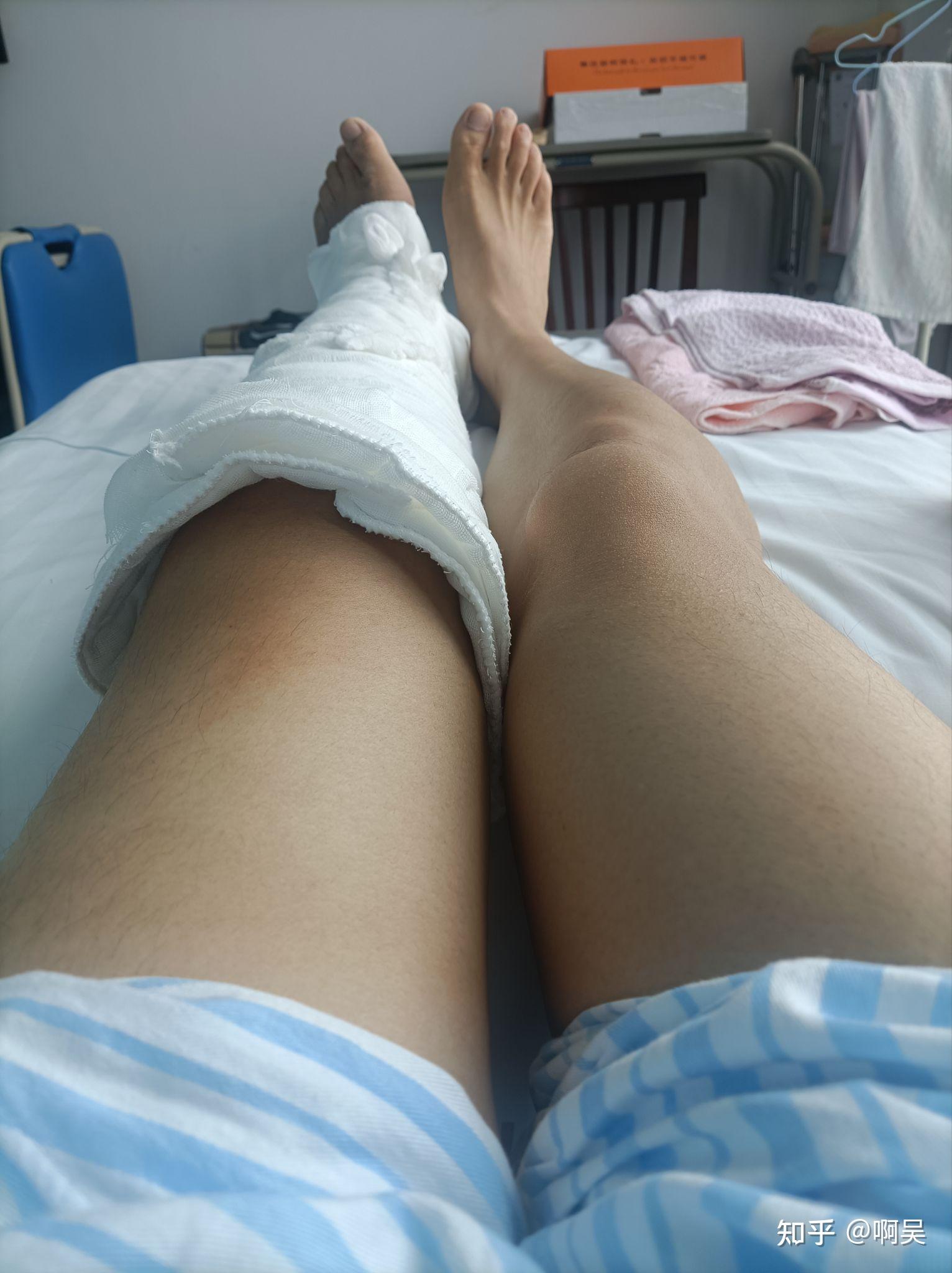 小腿伤病情况跟第六场时差不多不在乎外界是否尊重我们的简单介绍